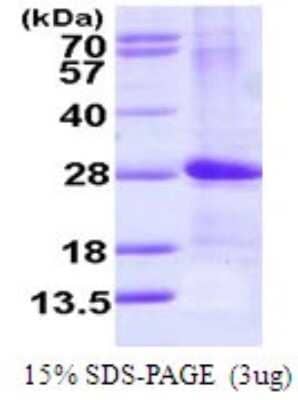 SDS-PAGE: Recombinant Human ARF4L His Protein [NBP1-72493]