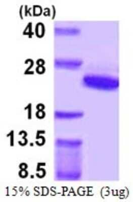 SDS-PAGE: Recombinant Human ARF5 His Protein [NBP1-72346]