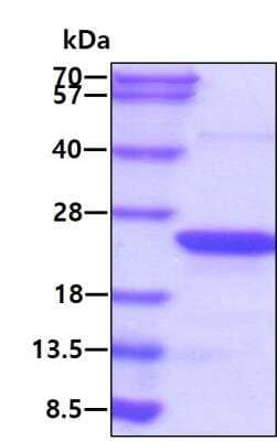 SDS-PAGE: Recombinant Human ARF6 His Protein [NBP1-49459]