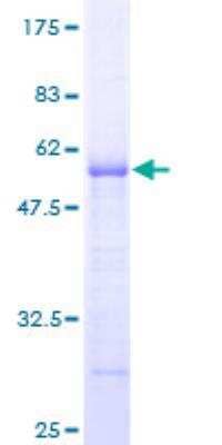 SDS-PAGE: Recombinant Human ARHGDIG GST (N-Term) Protein [H00000398-P01]