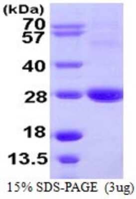 SDS-PAGE: Recombinant Human ARL11 His Protein [NBP1-72376]