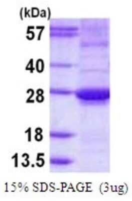 SDS-PAGE: Recombinant Human ARL15 His Protein [NBP1-72497]