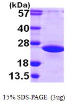 SDS-PAGE: Recombinant Human ARL2 His Protein [NBP1-50929]