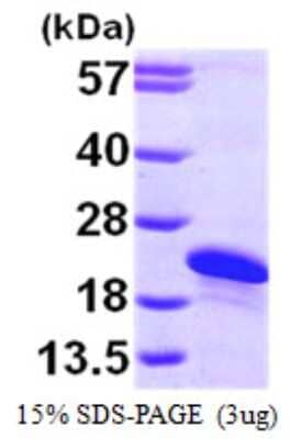 SDS-PAGE: Recombinant Human ARL2BP His Protein [NBP1-50851]