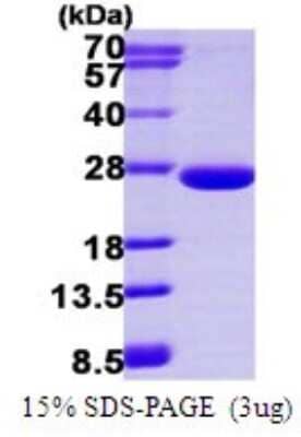 SDS-PAGE: Recombinant Human ARL3 His Protein [NBP1-72464]