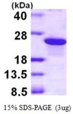 SDS-PAGE: Recombinant Human ARL5B His Protein [NBP1-72400]