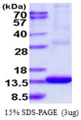 SDS-PAGE: Recombinant Human ARL9 His Protein [NBP1-78836]