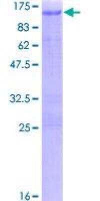 SDS-PAGE: Recombinant Human ARNT/HIF-1 beta GST (N-Term) Protein [H00000405-P01]