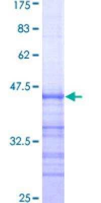 SDS-PAGE: Recombinant Human ARNT/HIF-1 beta GST (N-Term) Protein [H00000405-Q01]