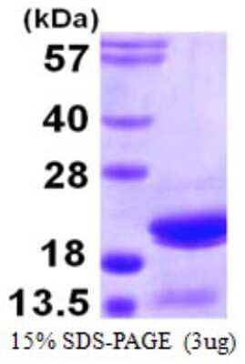 SDS-PAGE: Recombinant Human ARPC5 His Protein [NBP1-72321]