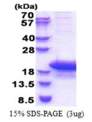 SDS-PAGE: Recombinant Human ARPP19 His Protein [NBP2-22727]