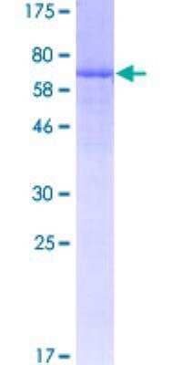 SDS-PAGE: Recombinant Human ART3 GST (N-Term) Protein [H00000419-P01]