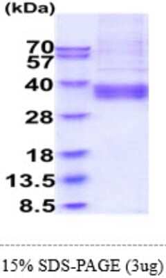 SDS-PAGE: Recombinant Human ART4 His Protein [NBP2-61454]