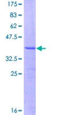 SDS-PAGE: Recombinant Human ASAH1 GST (N-Term) Protein [H00000427-Q01]