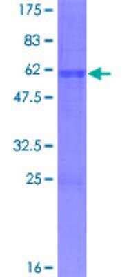 SDS-PAGE: Recombinant Human ASCL1/Mash1 GST (N-Term) Protein [H00000429-P01]