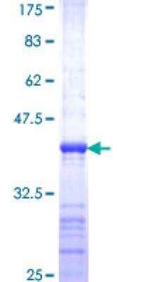 SDS-PAGE: Recombinant Human ASCL1/Mash1 GST (N-Term) Protein [H00000429-Q01]