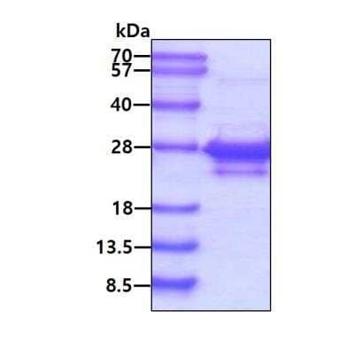 SDS-PAGE: Recombinant Human ASF1a His Protein [NBC1-22941]