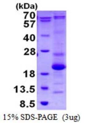 SDS-PAGE: Recombinant Human ASF1b His Protein [NBP1-98888]