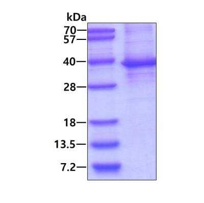 SDS-PAGE: Recombinant Human ASMT His Protein [NBP2-22666]