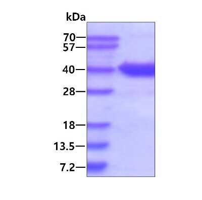 SDS-PAGE: Recombinant Human ASPA His Protein [NBP1-99096]