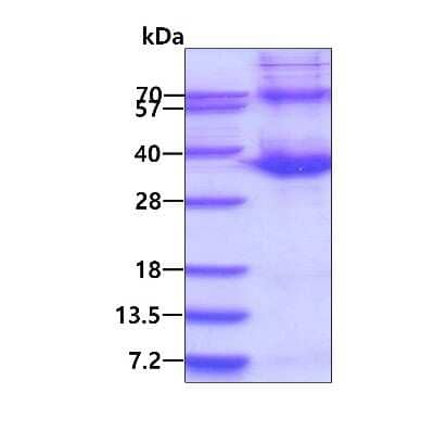 SDS-PAGE: Recombinant Human ATF1 His Protein [NBP1-78873]