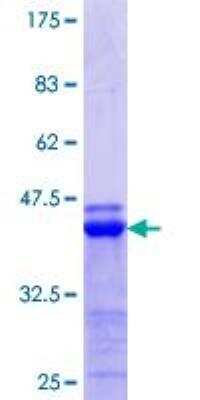 SDS-PAGE: Recombinant Human ATF6 beta GST (N-Term) Protein [H00001388-Q01]