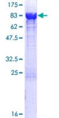 SDS-PAGE: Recombinant Human ATIC GST (N-Term) Protein [H00000471-P01]