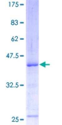 SDS-PAGE: Recombinant Human ATM GST (N-Term) Protein [H00000472-P01]