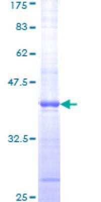 SDS-PAGE: Recombinant Human ATM GST (N-Term) Protein [H00000472-Q01]