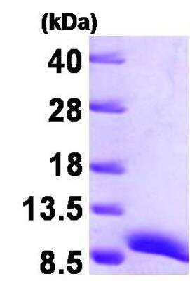 SDS-PAGE: Recombinant Human ATOX1 His Protein [NBP1-30171]