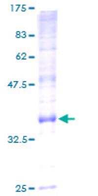 SDS-PAGE: Recombinant Human ATP5G2 GST (N-Term) Protein [H00000517-P01]