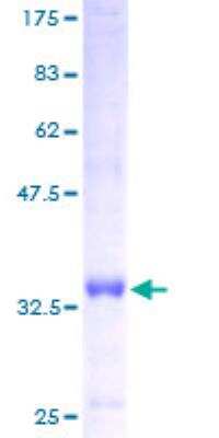 SDS-PAGE: Recombinant Human ATP5I GST (N-Term) Protein [H00000521-P01]