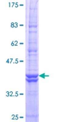 SDS-PAGE: Recombinant Human ATP6V0C GST (N-Term) Protein [H00000527-P01]