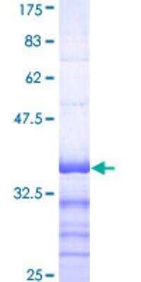 SDS-PAGE: Recombinant Human ATP7A GST (N-Term) Protein [H00000538-Q01]