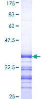 SDS-PAGE: Recombinant Human ATP7b GST (N-Term) Protein [H00000540-Q01]