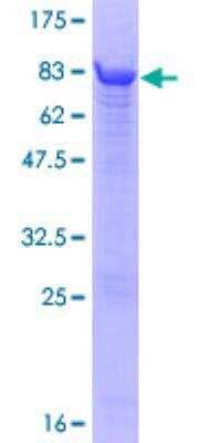 SDS-PAGE: Recombinant Human ATPB GST (N-Term) Protein [H00000506-P01]