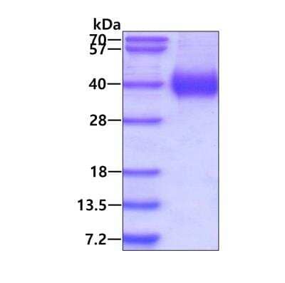 SDS-PAGE: Recombinant Human ATPase Na+/K+ beta 2 His Protein [NBP3-15116]