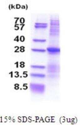 SDS-PAGE: Recombinant Human ATPase Na+/K+ beta 3 His Protein [NBP2-51690]