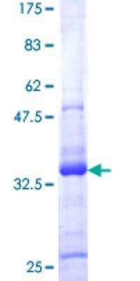 SDS-PAGE: Recombinant Human ATRX GST (N-Term) Protein [H00000546-P01]