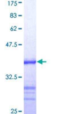 SDS-PAGE: Recombinant Human ATRX GST (N-Term) Protein [H00000546-Q01]