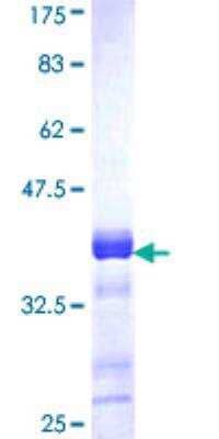 SDS-PAGE: Recombinant Human Acetyl Coenzyme A Carboxylase Beta GST (N-Term) Protein [H00000032-Q01]