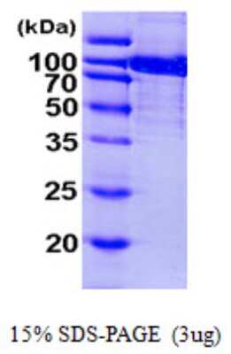 SDS-PAGE: Recombinant Human Aconitase 1 His Protein [NBP1-50955]