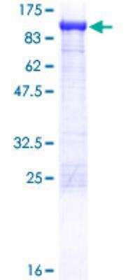 SDS-PAGE: Recombinant Human Aconitase 2 GST (N-Term) Protein [H00000050-P01]