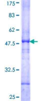 SDS-PAGE: Recombinant Human Aconitase 2 GST (N-Term) Protein [H00000050-Q01]