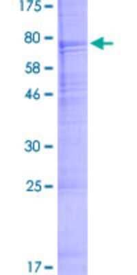 SDS-PAGE: Recombinant Human Acrosin GST (N-Term) Protein [H00000049-P01]