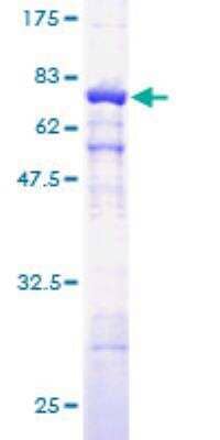 SDS-PAGE: Recombinant Human Actin Gamma 1 GST (N-Term) Protein [H00000071-P01]