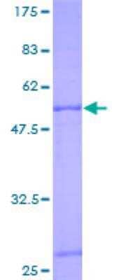 SDS-PAGE: Recombinant Human Adenine Nucleotide Translocator 2 GST (N-Term) Protein [H00000292-P01]