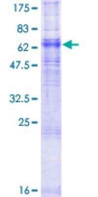 SDS-PAGE: Recombinant Human Adenosine A2aR GST (N-Term) Protein [H00000135-P02]