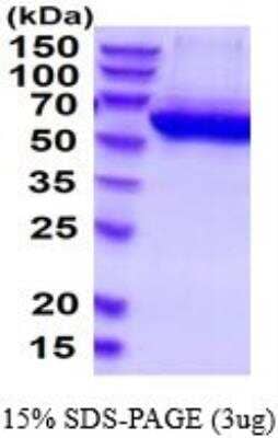 SDS-PAGE: Recombinant Human Adenosine Deaminase 2/CECR1 His Protein [NBP2-52348]