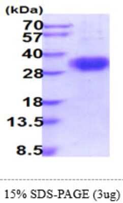 SDS-PAGE: Recombinant Human Fc gamma RIIIB/CD16b His Protein [NBP2-61175]